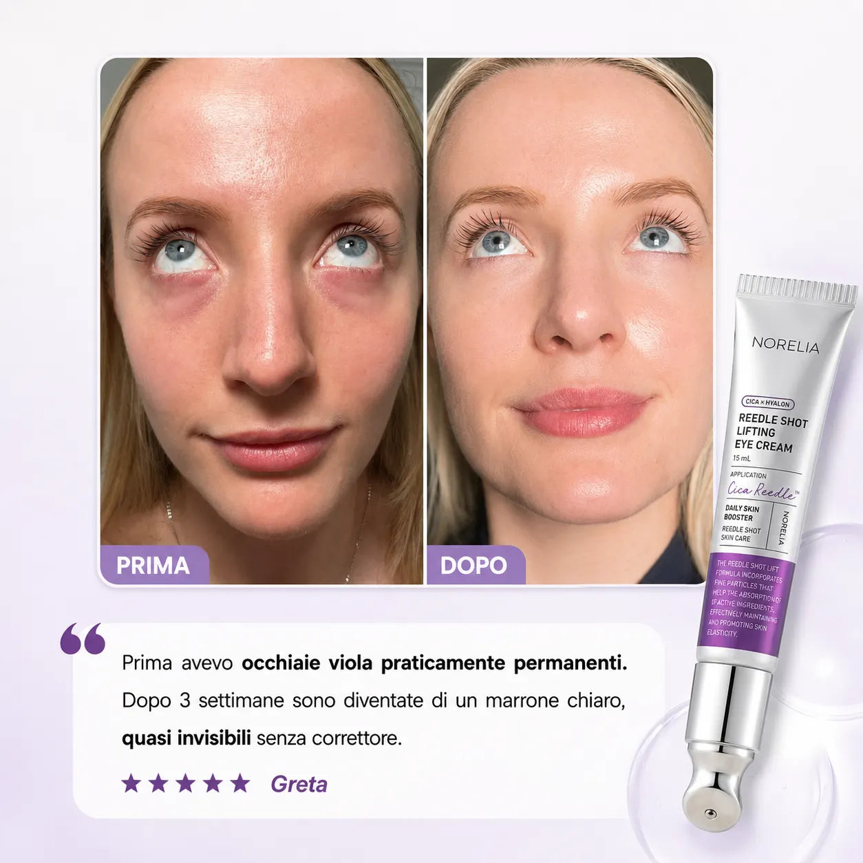Crema Vibrante K-Beauty per Occhiaie, Borse e Rughe
