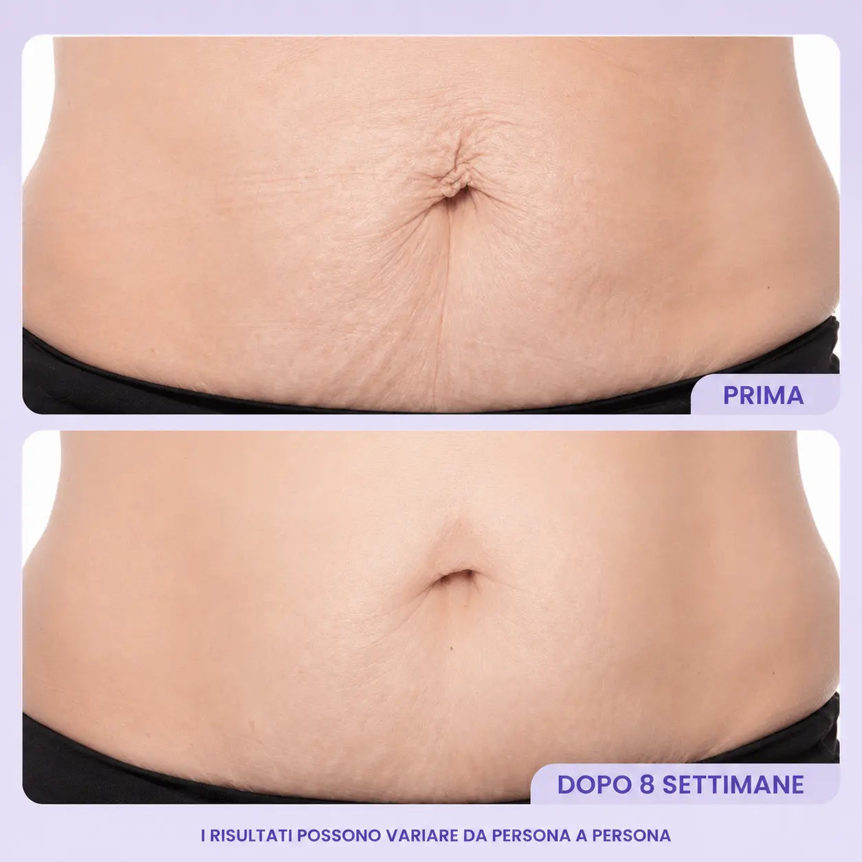Crema Rassodante & Levigante Ventre