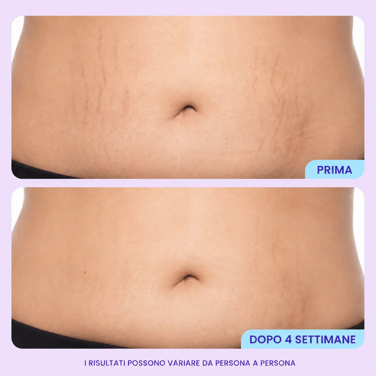 Crema Rassodante & Levigante Ventre