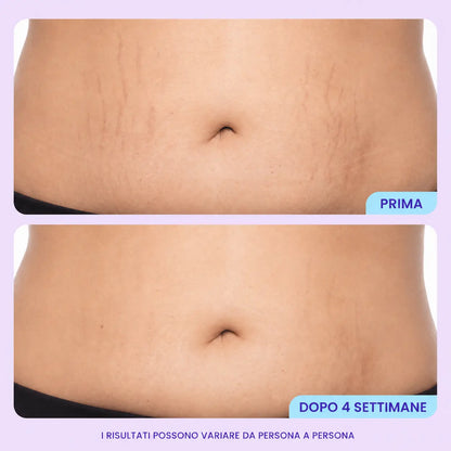 Crema Rassodante & Levigante Ventre